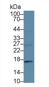 p16INK4a / CDKN2A Antibody - Western Blot; Sample: Human MCF7 cell lysate; Primary Ab: 1µg/ml Rabbit Anti-Human CDKN2A Antibody Second Ab: 0.2µg/mL HRP-Linked Caprine Anti-Rabbit IgG Polyclonal Antibody (Catalog: SAA544Rb19