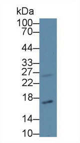 p16INK4a / CDKN2A Antibody - Western Blot; Sample: Human HepG2 cell lysate; Primary Ab: 1µg/ml Rabbit Anti-Human CDKN2A Antibody Second Ab: 0.2µg/mL HRP-Linked Caprine Anti-Rabbit IgG Polyclonal Antibody (Catalog: SAA544Rb19