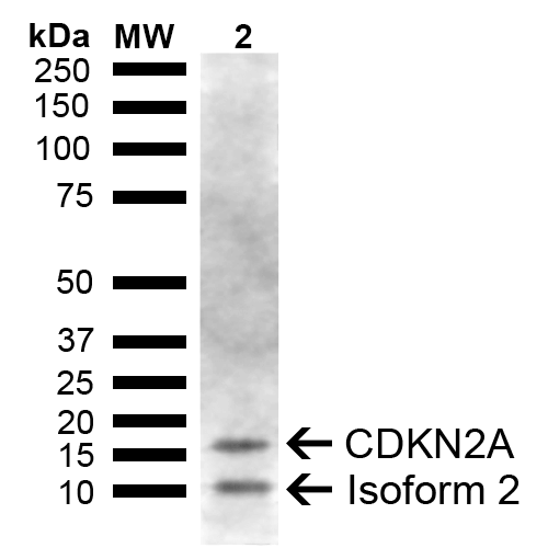 p16INK4a / CDKN2A Antibody - Western blot analysis of Mouse Liver showing detection of ~16.5, 11.2 kDa CDKN2A protein using Rabbit Anti-CDKN2A Polyclonal Antibody. Lane 1: Molecular Weight Ladder (MW). Lane 2: Mouse Liver. Load: 15 µg. Block: 5% Skim Milk in 1X TBST. Primary Antibody: Rabbit Anti-CDKN2A Polyclonal Antibody  at 1:1000 for 2 hours at RT. Secondary Antibody: Goat Anti-Rabbit IgG: HRP at 1:5000 for 1 hour at RT. Color Development: ECL solution for 5 min at RT. Predicted/Observed Size: ~16.5, 11.2 kDa.