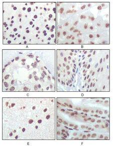 p16INK4a / CDKN2A Antibody - p16INK4a Antibody in Immunohistochemistry (IHC)