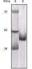 p16INK4a / CDKN2A Antibody - p16INK4a Antibody in Western Blot (WB)