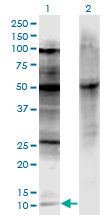 p16INK4a / CDKN2A Antibody - Western Blot analysis of CDKN2A expression in transfected 293T cell line by CDKN2A monoclonal antibody (M06), clone 3F3.Lane 1: CDKN2A transfected lysate (Predicted MW: 11.66 KDa).Lane 2: Non-transfected lysate.