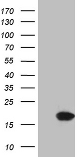 p16INK4a / CDKN2A Antibody - HEK293T cells were transfected with the pCMV6-ENTRY control. (Left lane) or pCMV6-ENTRY CDKN2A. (Right lane) cDNA for 48 hrs and lysed. Equivalent amounts of cell lysates. (5 ug per lane) were separated by SDS-PAGE and immunoblotted with anti-CDKN2A. (1:2000)