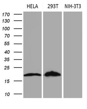 p16INK4a / CDKN2A Antibody - Western blot analysis of extracts. (35ug) from 3 different cell lines by using anti-CDKN2A monoclonal antibody. (1:500)