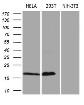 p16INK4a / CDKN2A Antibody - Western blot analysis of extracts. (35ug) from 3 different cell lines by using anti-CDKN2A monoclonal antibody. (1:500)