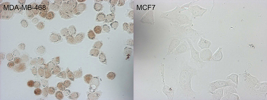 p16INK4a / CDKN2A Antibody - Immunocytochemistry staining of MDA-MB-468 cells using anti-CDKN2A mouse monoclonal antibody. The right is MCF7 cells as negative control. (1:100)(1:50)