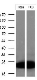p16INK4a / CDKN2A Antibody - Western blot analysis of extracts. (10ug) from 2 different cell lines by using anti-CDKN2A monoclonal antibody at 1:200.
