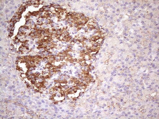 p16INK4a / CDKN2A Antibody - Immunohistochemical staining of paraffin-embedded Human pancreas tissue within the normal limits using anti-CDKN2A mouse monoclonal antibody. (Heat-induced epitope retrieval by Tris-EDTA, pH8.0)(1:150)