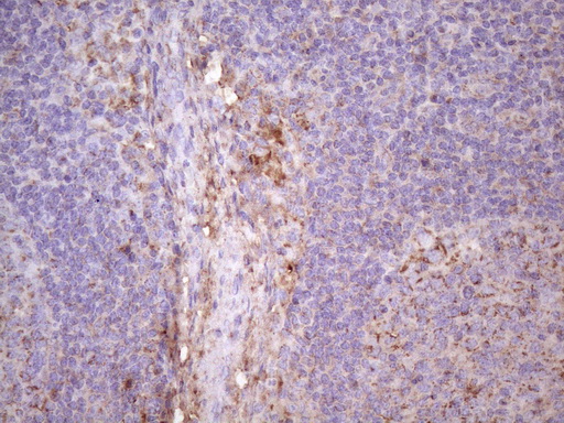 p16INK4a / CDKN2A Antibody - Immunohistochemical staining of paraffin-embedded Human lymph node tissue within the normal limits using anti-CDKN2A mouse monoclonal antibody. (Heat-induced epitope retrieval by Tris-EDTA, pH8.0)(1:150)
