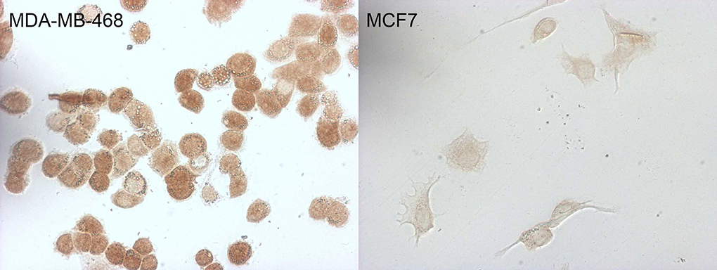 p16INK4a / CDKN2A Antibody - Immunocytochemistry staining of MDA-MB-468 cells using anti-CDKN2A mouse monoclonal antibody. The right is MCF7 cells as negative control. (1:100)
