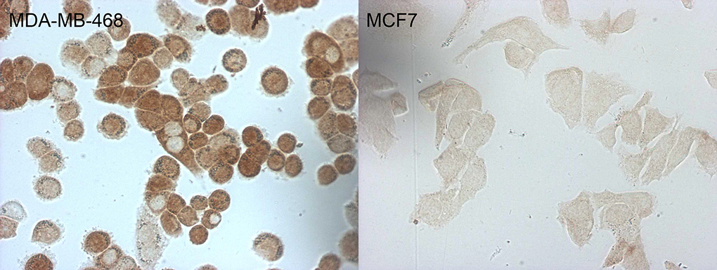 p16INK4a / CDKN2A Antibody - Immunocytochemistry staining of MDA-MB-468 cells using anti-CDKN2A mouse monoclonal antibody. The right is MCF7 cells as negative control. (1:50)