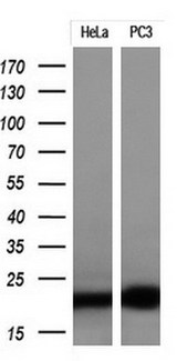 p16INK4a / CDKN2A Antibody - Western blot analysis of extracts. (10ug) from 2 different cell lines by using anti-CDKN2A monoclonal antibody at 1:200.
