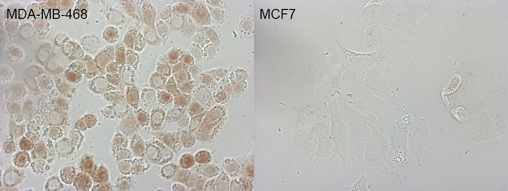 p16INK4a / CDKN2A Antibody - Immunocytochemistry staining of MDA-MB-468 cells using anti-CDKN2A mouse monoclonal antibody. The right is MCF7 cells as negative control. (1:400)