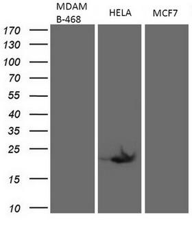 p16INK4a / CDKN2A Antibody - Western blot analysis of extracts. (35ug) from 3 different cell lines by using anti-CDKN2A monoclonal antibody 1.MDAMB-468;2.Hela;3.MCF7). (1:500)