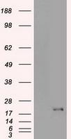 p16INK4a / CDKN2A Antibody - HEK293T cells were transfected with the pCMV6-ENTRY control (Left lane) or pCMV6-ENTRY P16 (Right lane) cDNA for 48 hrs and lysed. Equivalent amounts of cell lysates (5 ug per lane) were separated by SDS-PAGE and immunoblotted with anti-P16.