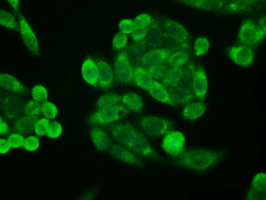 p16INK4a / CDKN2A Antibody - Immunofluorescent staining of HeLa cells using anti-P16 mouse monoclonal antibody.