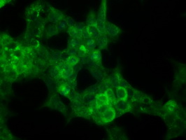 p16INK4a / CDKN2A Antibody - Immunofluorescent staining of HepG2 cells using anti-P16 mouse monoclonal antibody.