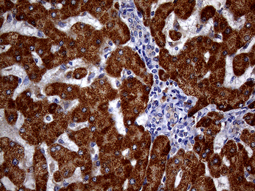 p16INK4a / CDKN2A Antibody - Immunohistochemical staining of paraffin-embedded Human liver tissue within the normal limits using anti-CDKN2A mouse monoclonal antibody. (Heat-induced epitope retrieval by 1mM EDTA in 10mM Tris buffer. (pH8.5) at 120°C for 3 min. (1:150)