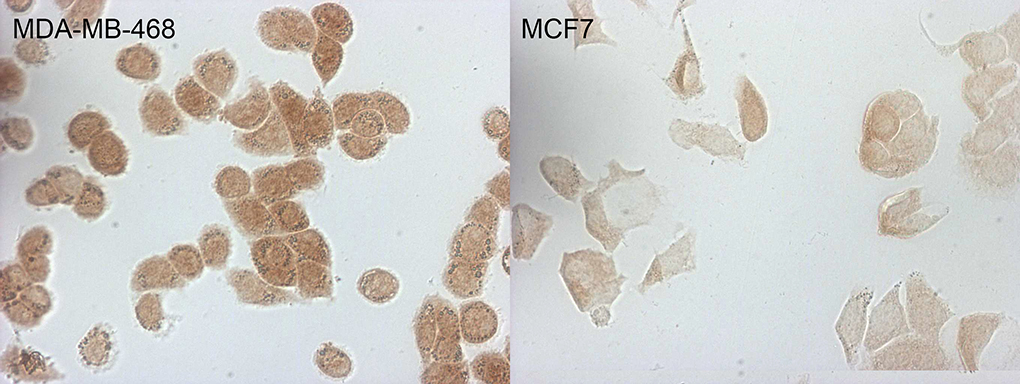 p16INK4a / CDKN2A Antibody - Immunocytochemistry staining of MDA-MB-468 cells using anti-CDKN2A mouse monoclonal antibody. The right is MCF7 cells as negative control. (1:100)