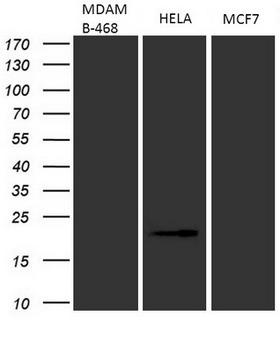 p16INK4a / CDKN2A Antibody - Western blot analysis of extracts. (35ug) from 3 different cell lines by using anti-CDKN2A monoclonal antibody. (HeLa: human; MCF7: human;MDAMB-468: human). (1:500)
