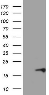 p16INK4a / CDKN2A Antibody - HEK293T cells were transfected with the pCMV6-ENTRY control (Left lane) or pCMV6-ENTRY CDKN2A (Right lane) cDNA for 48 hrs and lysed. Equivalent amounts of cell lysates (5 ug per lane) were separated by SDS-PAGE and immunoblotted with anti-CDKN2A.