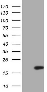p16INK4a / CDKN2A Antibody - HEK293T cells were transfected with the pCMV6-ENTRY control (Left lane) or pCMV6-ENTRY CDKN2A (Right lane) cDNA for 48 hrs and lysed. Equivalent amounts of cell lysates (5 ug per lane) were separated by SDS-PAGE and immunoblotted with anti-CDKN2A.