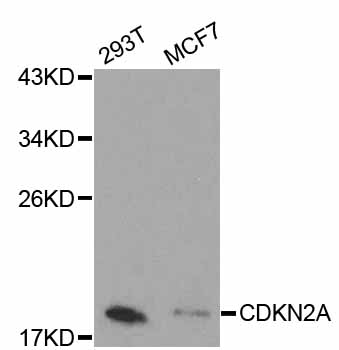 p16INK4a / CDKN2A Antibody - Western blot analysis of extracts of various cell lines, using CDKN2A antibody. The secondary antibody used was an HRP Goat Anti-Rabbit IgG (H+L) at 1:10000 dilution. Lysates were loaded 25ug per lane and 3% nonfat dry milk in TBST was used for blocking.