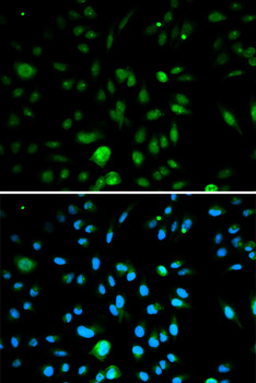p16INK4a / CDKN2A Antibody - Immunofluorescence analysis of A549 cells using CDKN2A antibody.