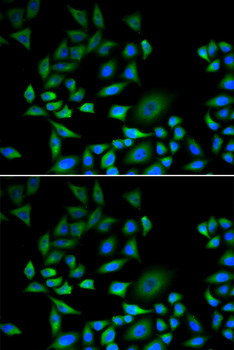 p16INK4a / CDKN2A Antibody - Immunofluorescence analysis of A549 cells using CDKN2A antibody.
