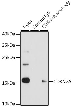 p16INK4a / CDKN2A Antibody - Immunoprecipitation analysis of 200ug extracts of 293T cells, using 3 ug CDKN2A antibody. Western blot was performed from the immunoprecipitate using CDKN2A antibody at a dilition of 1:1000.