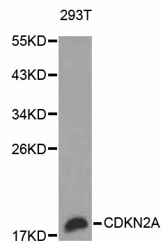 p16INK4a / CDKN2A Antibody - Western blot analysis of extracts of 293T cells, using CDKN2A antibody. The secondary antibody used was an HRP Goat Anti-Rabbit IgG (H+L) at 1:10000 dilution. Lysates were loaded 25ug per lane and 3% nonfat dry milk in TBST was used for blocking.
