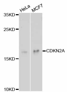 p16INK4a / CDKN2A Antibody - Western blot analysis of extracts of various cell lines, using CDKN2A antibody at 1:1000 dilution. The secondary antibody used was an HRP Goat Anti-Rabbit IgG (H+L) at 1:10000 dilution. Lysates were loaded 25ug per lane and 3% nonfat dry milk in TBST was used for blocking. An ECL Kit was used for detection and the exposure time was 90s.