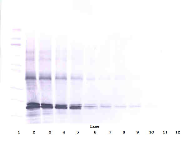 p16INK4a / CDKN2A Antibody - Anti-Human p16-INK4a-TAT Western Blot Reduced