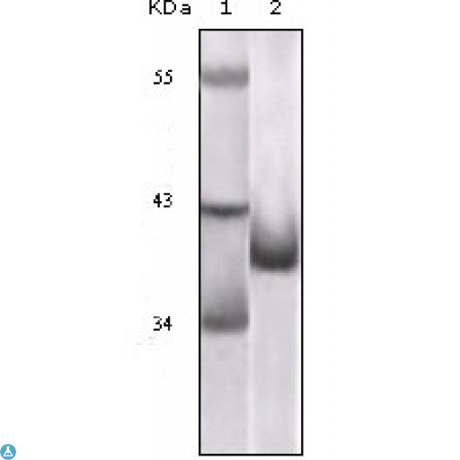 p16INK4a / CDKN2A Antibody - Western Blot (WB) analysis using p16 Monoclonal Antibody against truncated p16 recombinant protein.