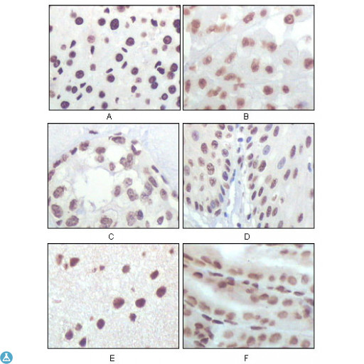 p16INK4a / CDKN2A Antibody - Immunohistochemistry (IHC) analysis of paraffin-embedded rat liver tissue (A), Human Brain tumor (B), breast cancer (C), esophageal epithelium tissue (D), Mouse Brain tissue (E) and stomach tisue (F), showing nuclear localization with DAB staining using p16 Mon.