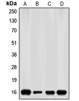 p16INK4a / CDKN2A Antibody - Western blot analysis of p16 INK4a expression in HEK293T (A); HeLa (B); mouse brain (C); rat brain (D) whole cell lysates.
