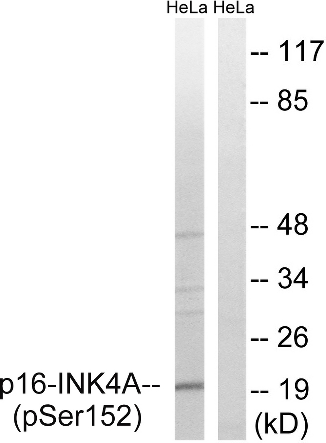 p16INK4a / CDKN2A Antibody - Western blot analysis of lysates from HeLa cells treated with EPO 20U/ml 15', using p16-INK4a (Phospho-Ser152) Antibody. The lane on the right is blocked with the phospho peptide.