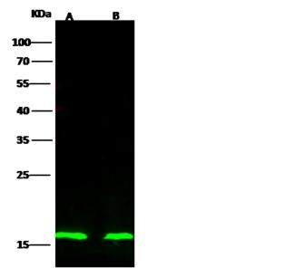 p16INK4a / CDKN2A Antibody - Anti-CDKN2A rabbit polyclonal antibody at 1:500 dilution. Lane A: Hela Whole Cell Lysate. Lane B: 293T Whole Cell Lysate. Lysates/proteins at 30 ug per lane. Secondary: Goat Anti-Rabbit IgG H&L (Dylight800) at 1:10000 dilution. Developed using the Odyssey technique. Performed under reducing conditions. Predicted band size: 17 kDa. Observed band size: 17 kDa.