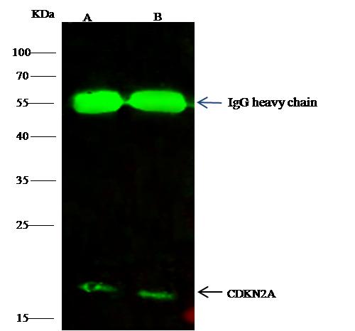 p16INK4a / CDKN2A Antibody - CDKN2A was immunoprecipitated using: Lane A: 0.5 mg Hela Whole Cell Lysate. Lane B: 0.5 mg 293T Whole Cell Lysate. 2 uL anti-CDKN2A rabbit polyclonal antibody and 60 ug of Immunomagnetic beads Protein G. Primary antibody: Anti-CDKN2A rabbit polyclonal antibody, at 1:200 dilution. Secondary antibody: Dylight 800-labeled antibody to rabbit IgG (H+L), at 1:5000 dilution. Developed using the odssey technique. Performed under reducing conditions. Predicted band size: 17 kDa. Observed band size: 17 kDa.