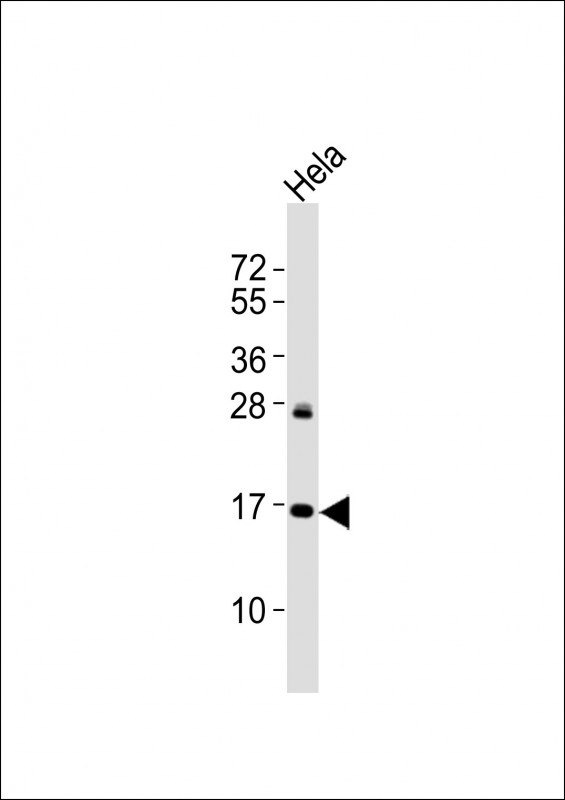 p16INK4a / CDKN2A Antibody - Anti p16-INK4A (S152) Antibody at 1:2000 dilution + HeLa whole cell lysates Lysates/proteins at 20 ug per lane. Secondary Goat Anti-Rabbit IgG, (H+L), Peroxidase conjugated at 1/10000 dilution Predicted band size : 17 kDa Blocking/Dilution buffer: 5% NFDM/TBST.
