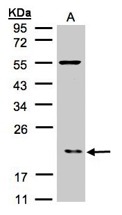 p21-ARC / ARPC3 Antibody - Sample (30 ug of whole cell lysate). A: Raji . 12% SDS PAGE. p21-ARC / ARPC3 antibody diluted at 1:500