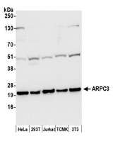 p21-ARC / ARPC3 Antibody - Detection of human and mouse ARPC3 by western blot. Samples: Whole cell lysate (50 µg) from HeLa, HEK293T, Jurkat, mouse TCMK-1, and mouse NIH 3T3 cells prepared using NETN lysis buffer. Antibody: Affinity purified rabbit anti-ARPC3 antibody used for WB at 0.1 µg/ml. Detection: Chemiluminescence with an exposure time of 30 seconds.