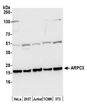 p21-ARC / ARPC3 Antibody - Detection of human and mouse ARPC3 by western blot. Samples: Whole cell lysate (50 µg) from HeLa, HEK293T, Jurkat, mouse TCMK-1, and mouse NIH 3T3 cells prepared using NETN lysis buffer. Antibody: Affinity purified rabbit anti-ARPC3 antibody used for WB at 0.1 µg/ml. Detection: Chemiluminescence with an exposure time of 30 seconds.