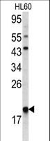 p21-ARC / ARPC3 Antibody - Western blot of ARPC3 antibody in HL60 cell line lysates(35 ug/lane). ARPC3 (arrow) was detected using the purified antibody.