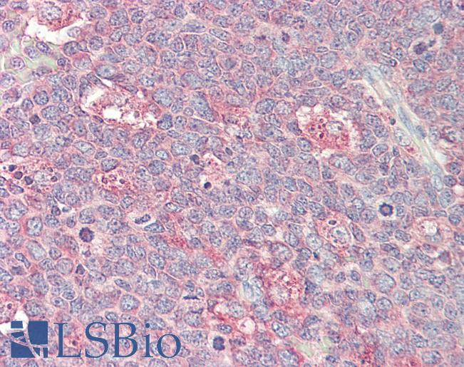 p21-ARC / ARPC3 Antibody - Anti-p21-ARC / ARPC3 antibody IHC staining of human tonsil. Immunohistochemistry of formalin-fixed, paraffin-embedded tissue after heat-induced antigen retrieval. Antibody concentration 20 ug/ml. This image was taken for the unconjugated form of this product. Other forms have not been tested.