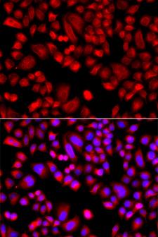 p21-ARC / ARPC3 Antibody - Immunofluorescence analysis of A549 cells.
