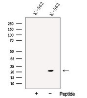 p21-ARC / ARPC3 Antibody - Western blot analysis of extracts of K562 cells using ARPC3 antibody. The lane on the left was treated with blocking peptide.