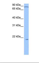 p21-ARC / ARPC3 Antibody - Fetal brain cell lysate. Antibody concentration: 0.5 ug/ml. Gel concentration: 12%.  This image was taken for the unconjugated form of this product. Other forms have not been tested.