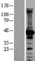 p21-ARC / ARPC3 Protein - Western validation with an anti-DDK antibody * L: Control HEK293 lysate R: Over-expression lysate