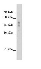 P2RX1 / P2X1 Antibody - HepG2 Cell Lysate.  This image was taken for the unconjugated form of this product. Other forms have not been tested.